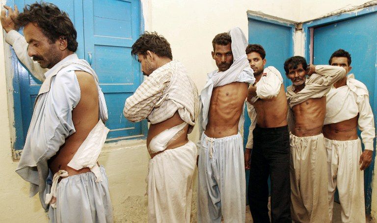 Sprzedam nerkę, wynajmę macicę, oddam kości na szkielet anatomiczny. Krwawa prawda o czerwonym rynku