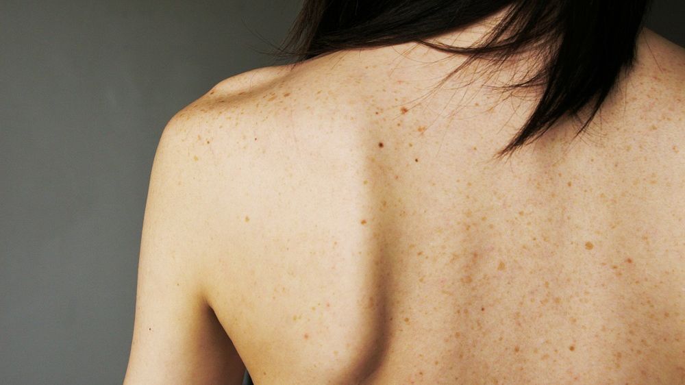 Nawet 15 proc. chorujących na COVID narzeka na bóle pleców