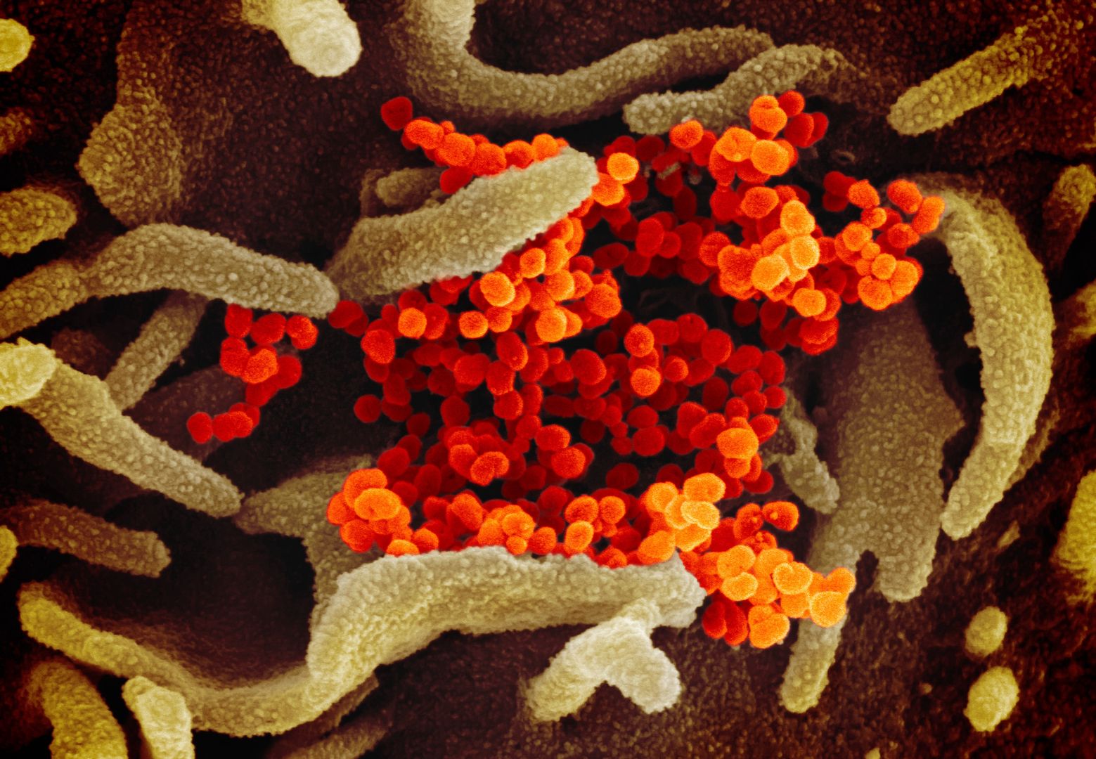 Koronawirus SARS-CoV-2 pod mikroskopem.