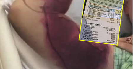 Chciał selfie z grzechotnikiem. Cudem przeżył, a potem dostał rachunek