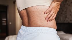 Zachoruje co 3. po 50-tce. "Dolegliwość trudna do zniesienia"