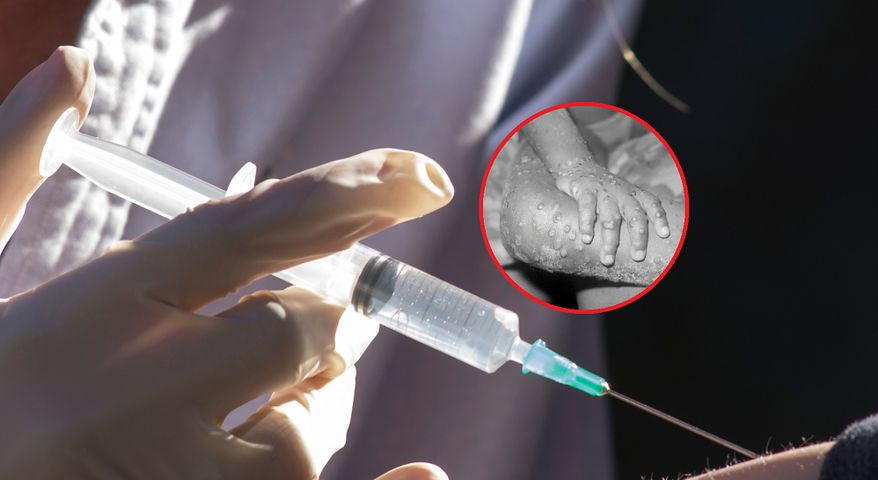 Moderna rozpoczyna badania nad szczepionką przeciwko małpiej ospie