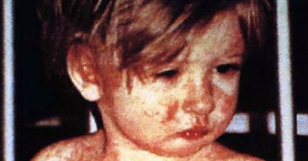 USA na granicy utraty statusu kraju wolnego od odry: najwyższa liczba zakażeń od 1990 roku