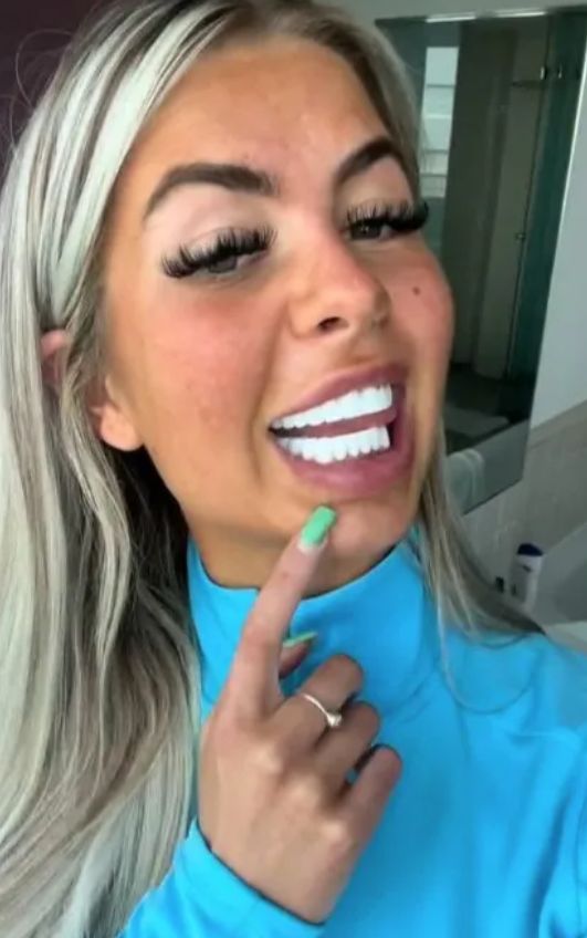 The TikToker has fallen for the "Turkish teeth" trend.