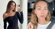 Sandra Kubicka o bólu po zabiegu twarzy. Porównała go do porodu