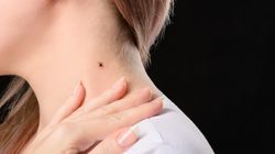 Kleszcz czy pieprzyk - jak rozpoznać?