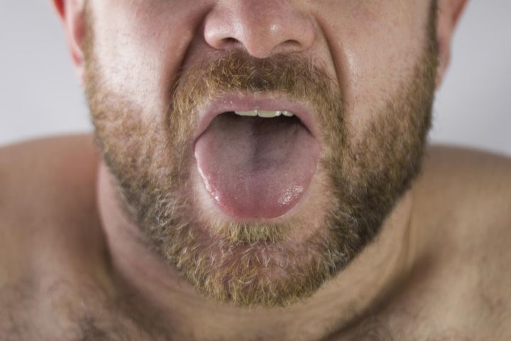 Pierwszym objawem cukrzycy może być ciągłe uczucie suchości w jamie ustnej