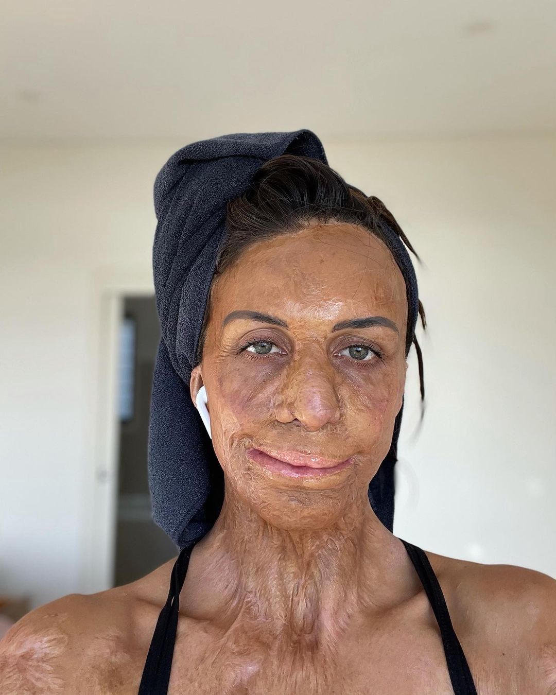 Turia Pitt