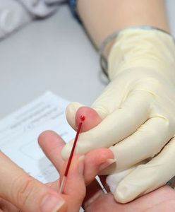 Badanie krwi pozwala przewidzieć nawrót nowotworu