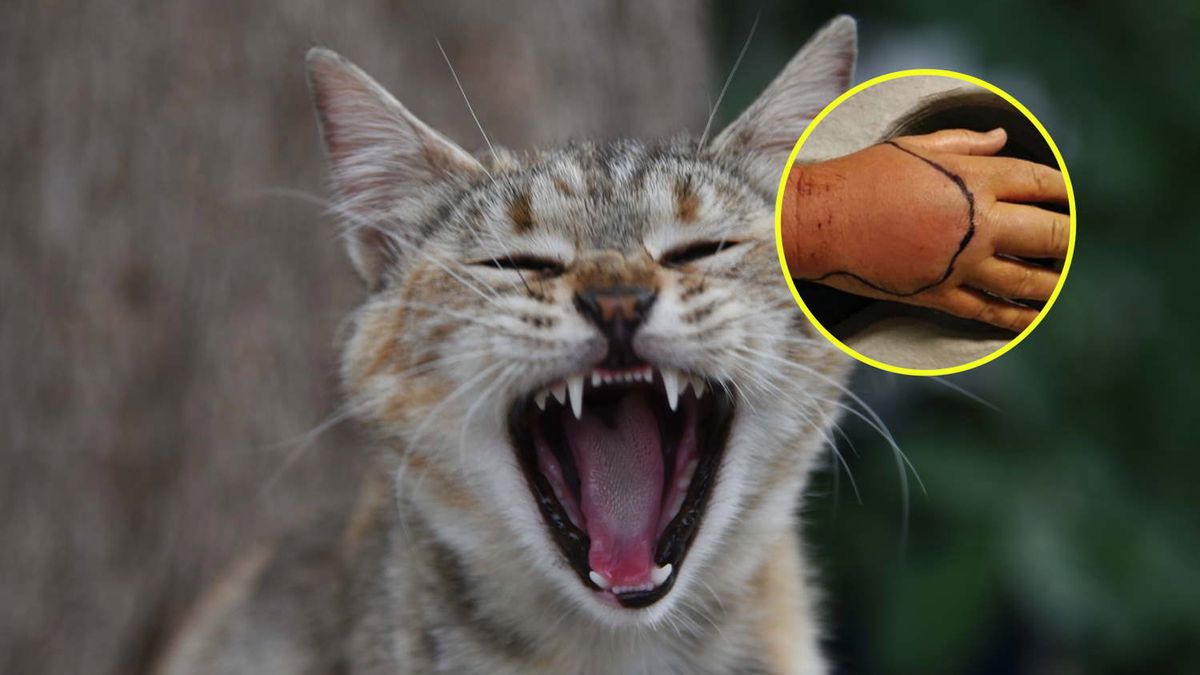 Dramatyczny przebieg infekcji. Wszystko przez ugryzienie kota