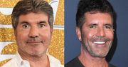 Simon Cowell USUNĄŁ z twarzy wypełniacze, bo... syn zaczął się go BAĆ: "WPADŁ W HISTERIĘ"