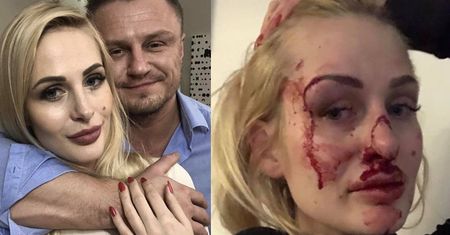Trener personalny ZMASAKROWAŁ TWARZ swojej dziewczyny?! "Bał się policji, UCIEKŁ..."