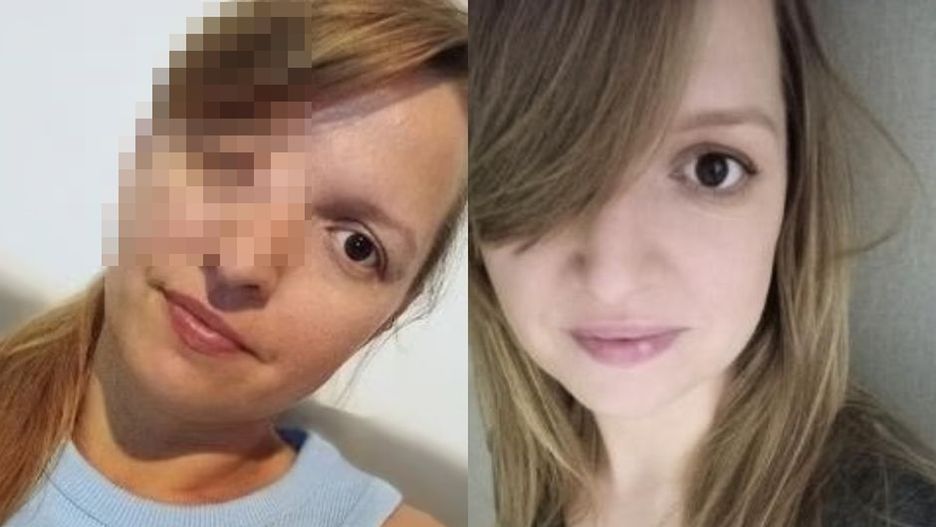 Tragiczny wypadek w dzieciństwie. Jedynym ratunkiem jest kosztowna operacja