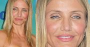 Co się stało z twarzą Cameron Diaz? (PORÓWNAJCIE!)