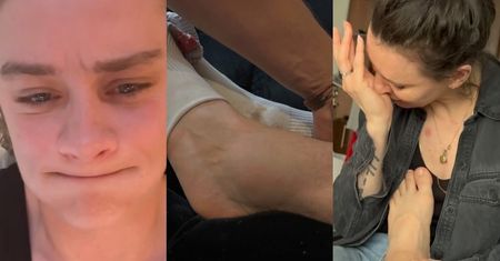 Katarzyna Zillmann pokazała, jak wyglądała jej noga przed "Azją Express"! Doznała poważnej KONTUZJI. "Huk ścięgna i ból na wymioty"