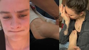 Katarzyna Zillmann pokazała, jak wyglądała jej noga przed "Azją Express"! Doznała poważnej KONTUZJI. "Huk ścięgna i ból na wymioty"