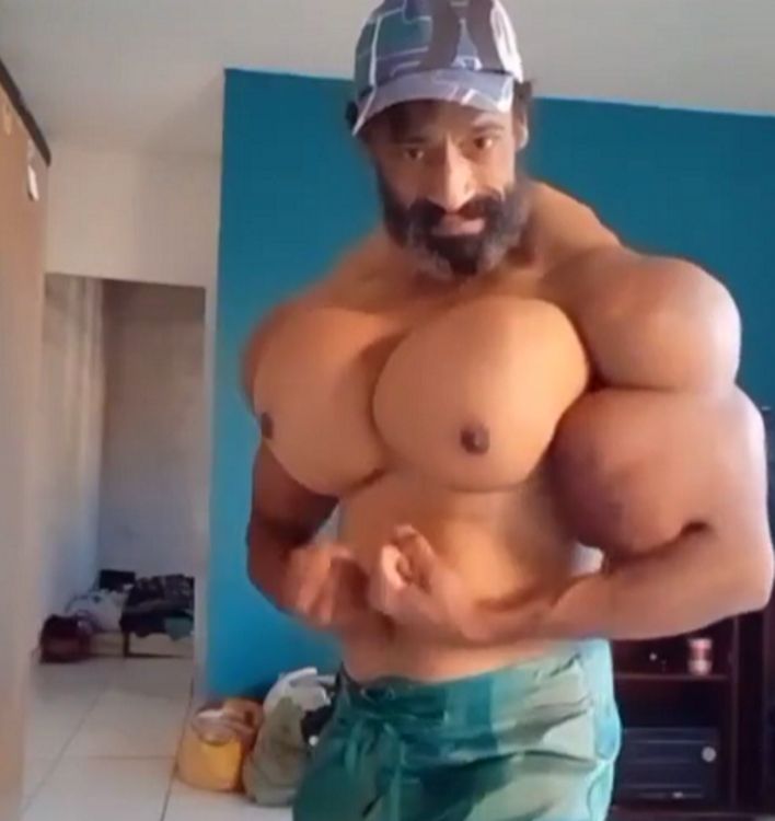 Mężczyzna wstrzykiwał sobie synthol w mięśnie