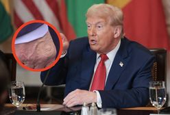 Dłoń Donalda Trumpa. Uwagę przyciągnął tajemniczy ślad