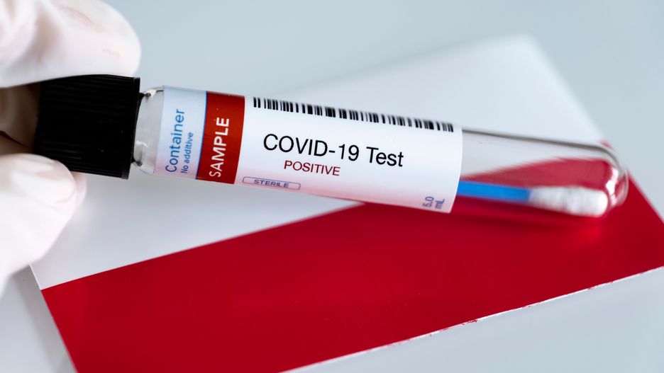 Test na COVID-19.