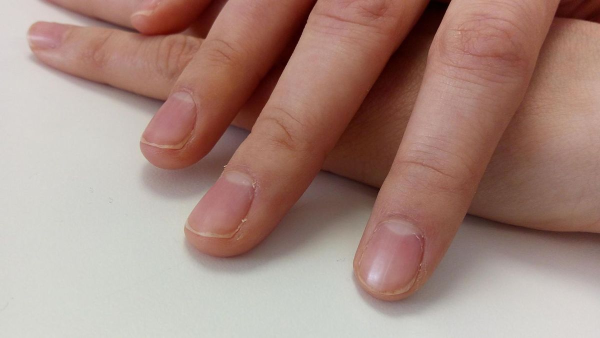 Obłączek to element budowy paznokcia