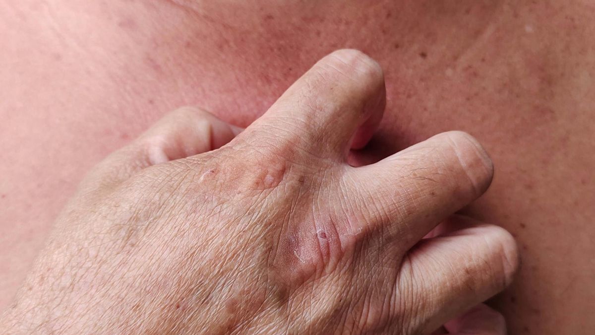 Tak trzustka daje znać, że dzieje się z nią coś złego