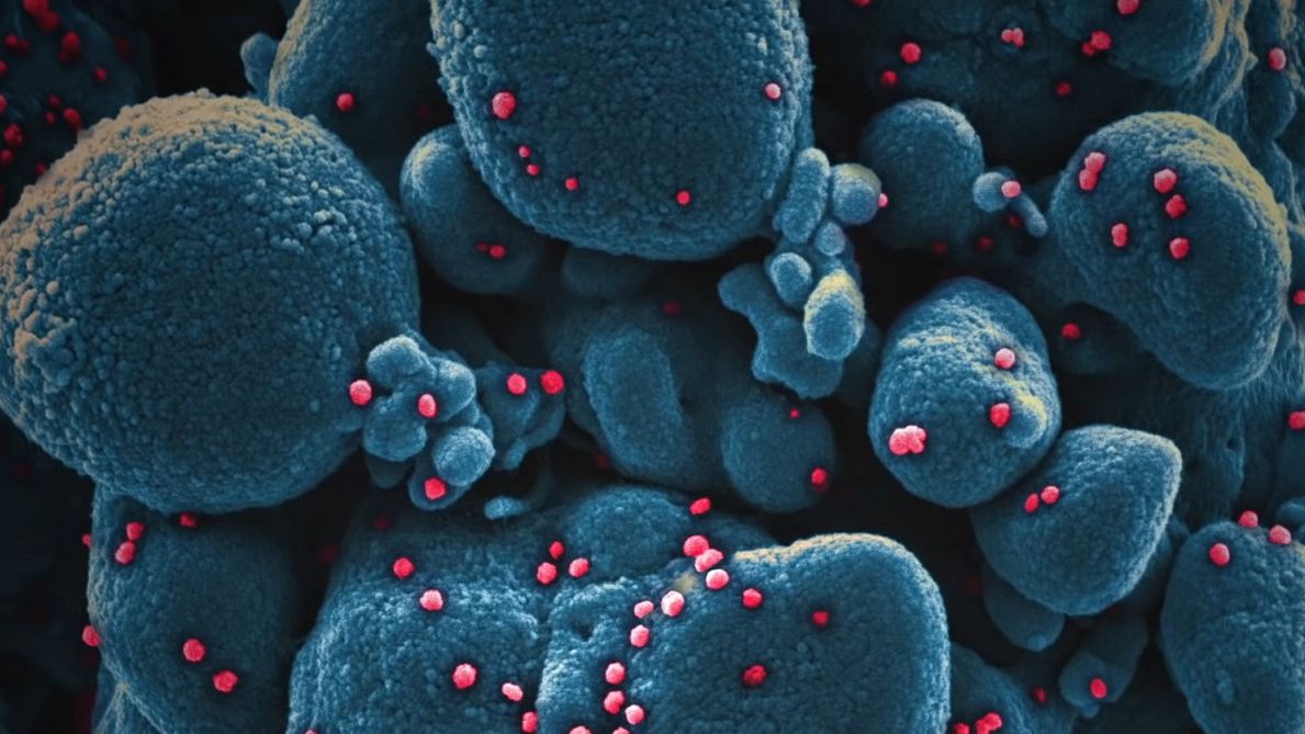 Koronawirus. WHO leci do Chin. Czy poznamy prawdę o pochodzeniu wirusa?