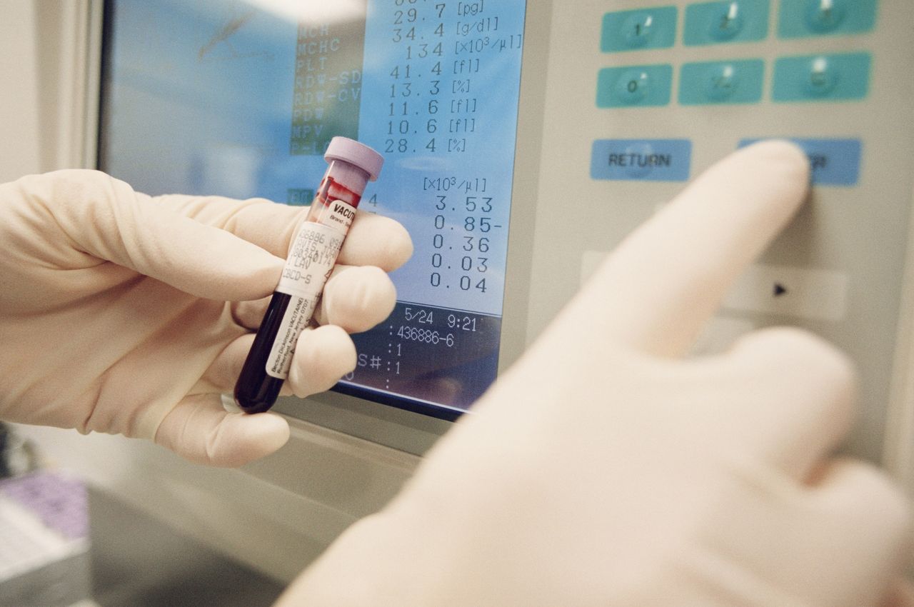 Dwa ważne parametry. Zdradzą, w jakiej kondycji są nerki