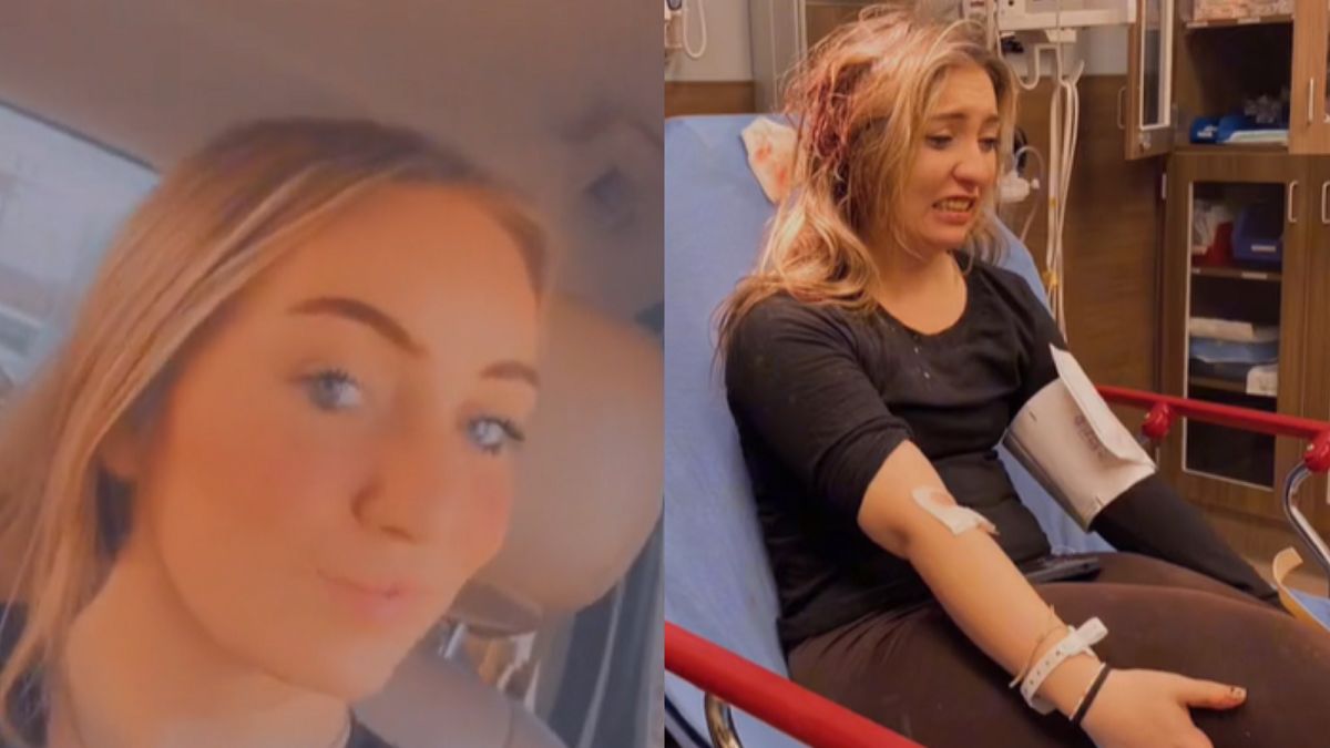 Miała wypadek samochodowy. Tak uszkodziła ją spinka do włosów. 