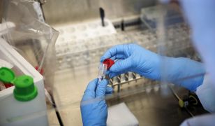 Koronawirus w Polsce: nowe przypadki. Najnowsze dane z Ministerstwa Zdrowia