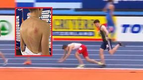 Polacy protestowali. Pokazał swoje plecy po upadku