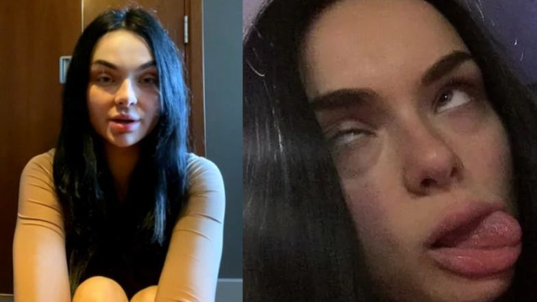 Zusje wspomina czasy uzależnienia i odwyku