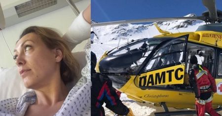 Anna Kalczyńska trafiła do szpitala po WYPADKU NA NARTACH! "Tak się zakończyła majóweczka 2017"
