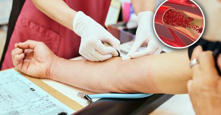Wyjątkowe odkrycie naukowców. Krew można oczyścić nie tylko z cholesterolu
