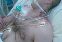 25-latek pobity w szpitalu psychiatrycznym?