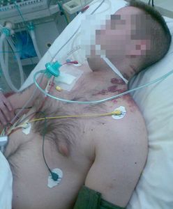 25-latek pobity w szpitalu psychiatrycznym?