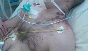 25-latek pobity w szpitalu psychiatrycznym?