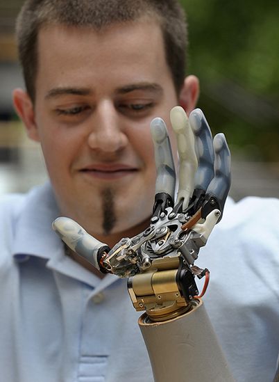 Nie żyje pierwszy człowiek z bioniczną ręką - miał wypadek samochodowy