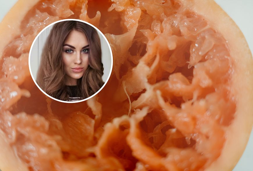 Te owoce najlepiej hamują stan zapalny. "Zapobiegają zakrzepom krwi"