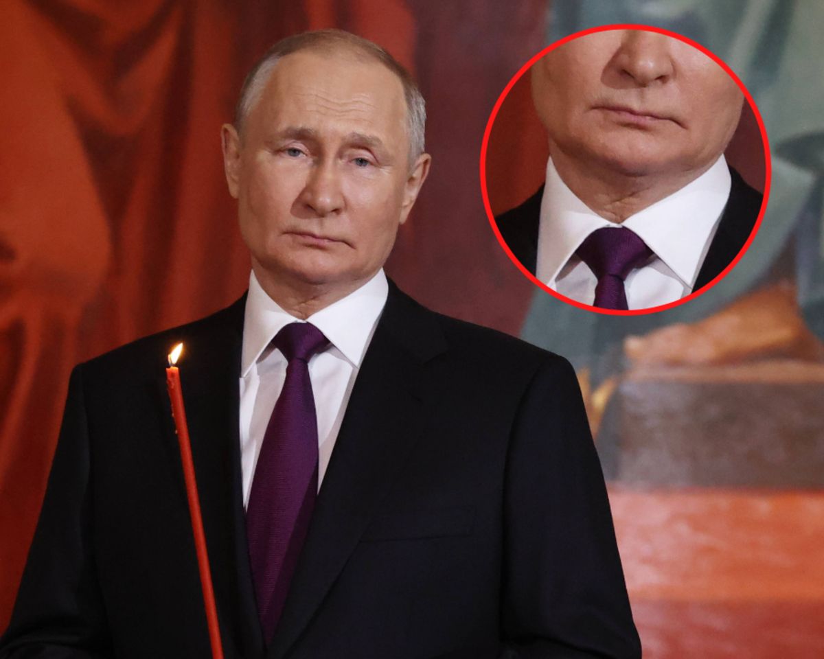 Tajemnicza blizna na szyi Władimira Putina 