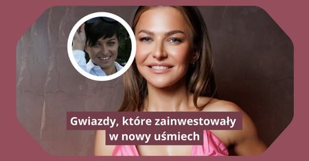 Te gwiazdy zainwestowały w nowy uśmiech. Zobaczcie, jak wyglądały wcześniej