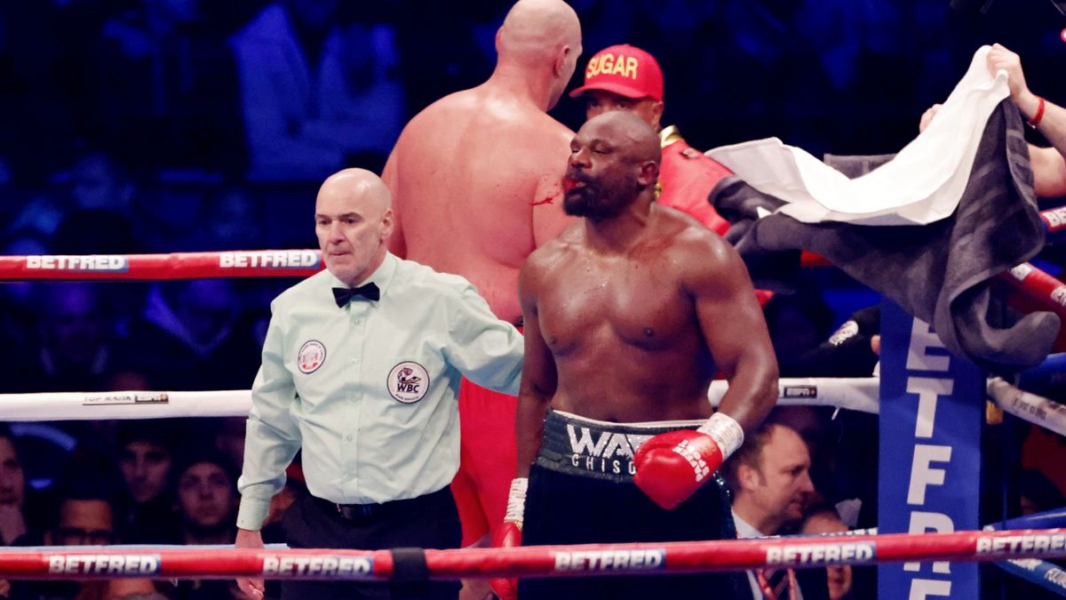 PAP/EPA / Dereck Chisora po walce z Tysonem Furym