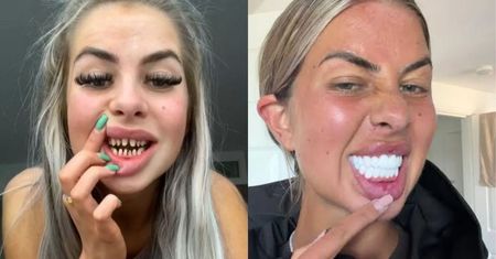 "Były robione w Turcji". Polski dentysta mówi o skutkach