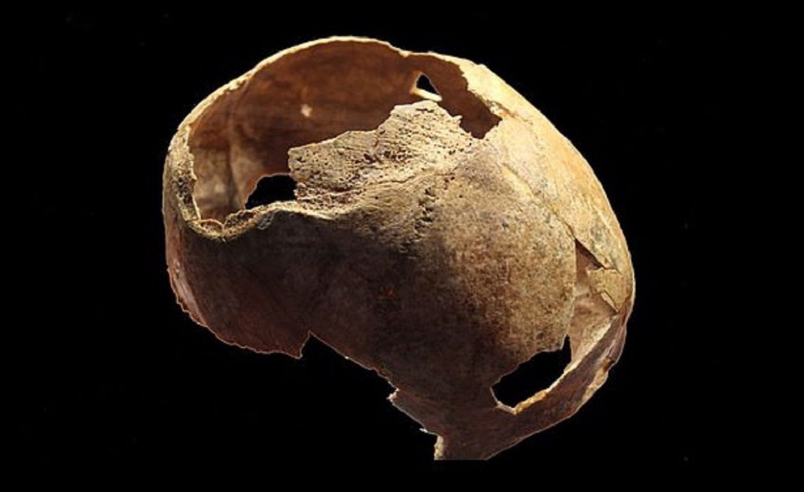 Niesamowite odkrycie sprzed 5 tys. lat. Na czaszce są ślady operacji