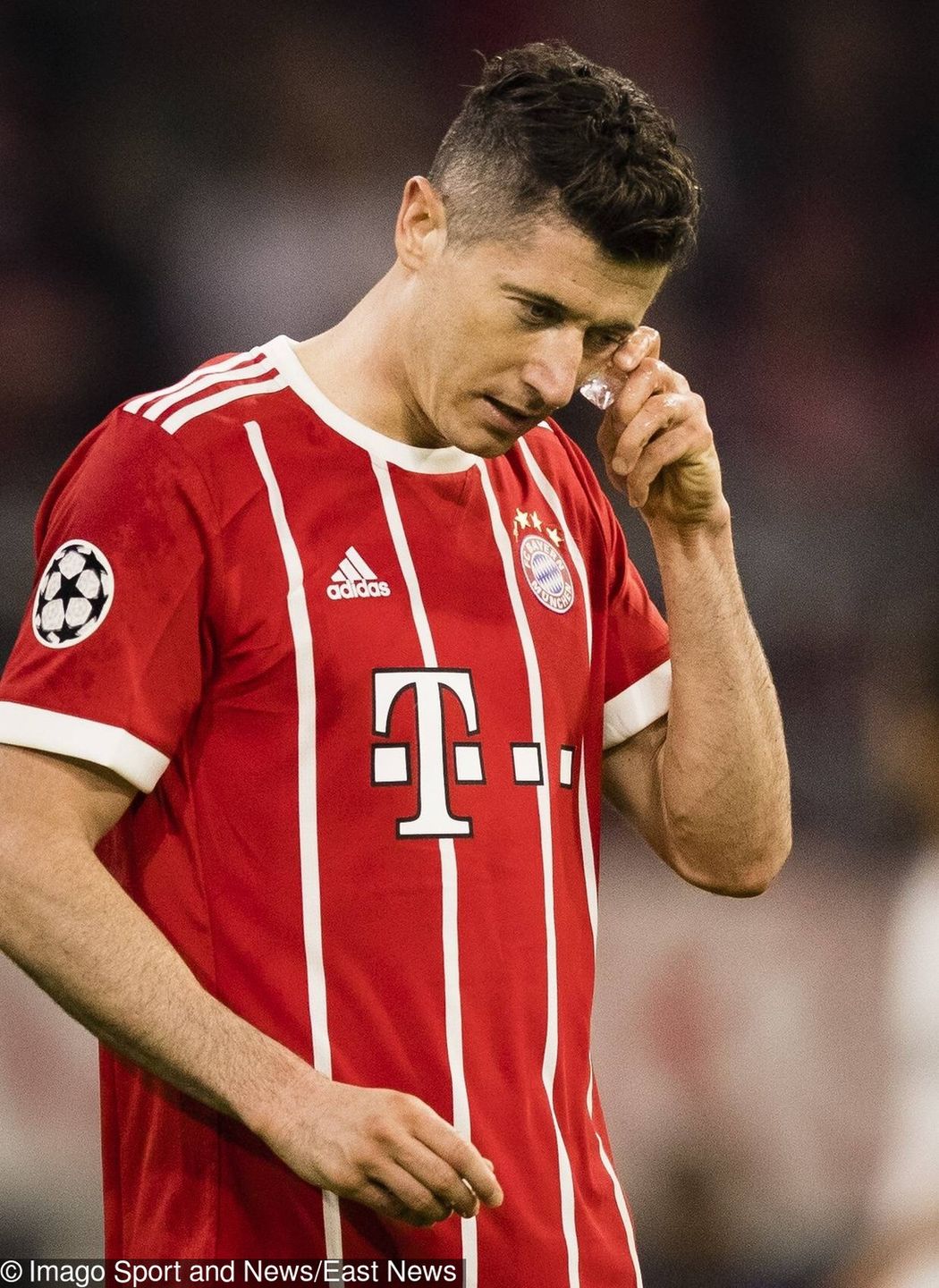Robert Lewandowski z podbitym okiem na meczu FC Sevilla – Bayern Monachium
