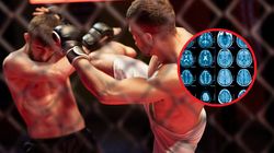 Większość kojarzy chorobę z jednego filmu. Ale nie tylko bokserzy są na nią narażeni