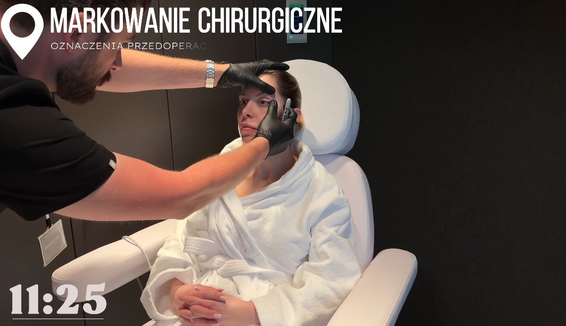 Julia von Stein podczas operacji plastycznej