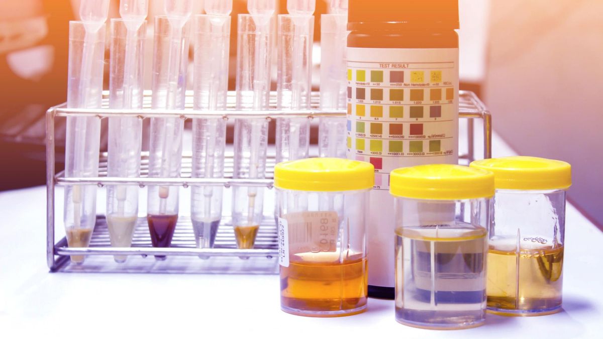 Płyny ustrojowe są niezbędne do funkcjonowania organizmu