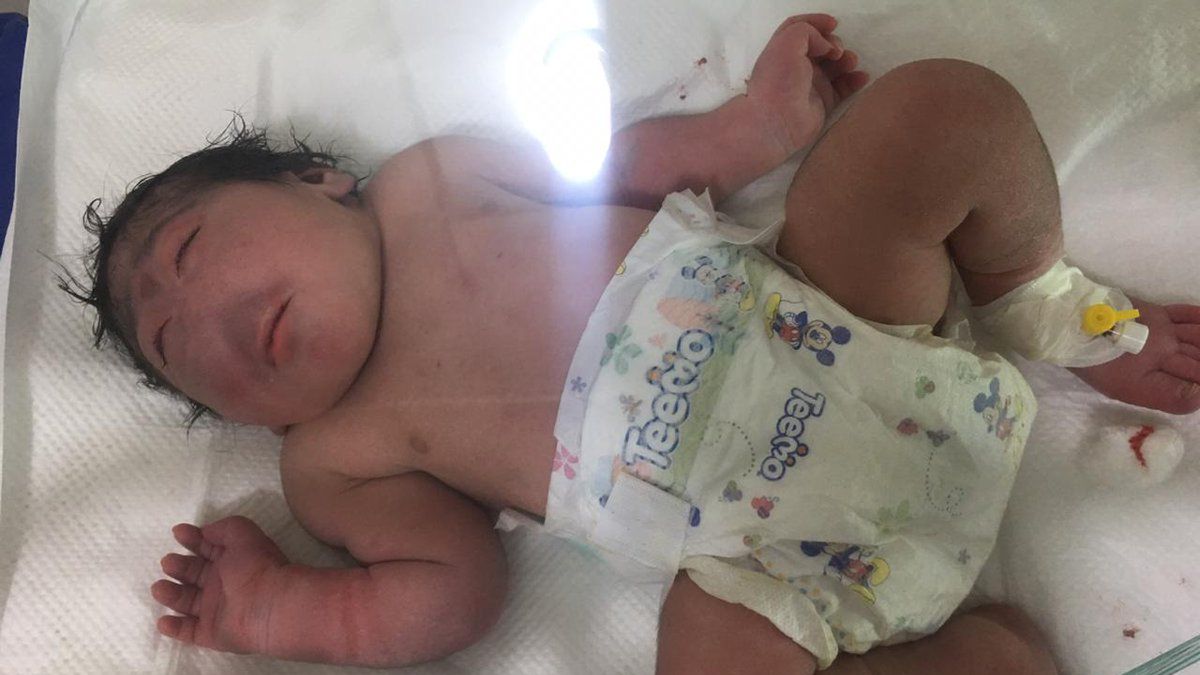 W irackiej Faludży urodziło się dziecko bez nosa