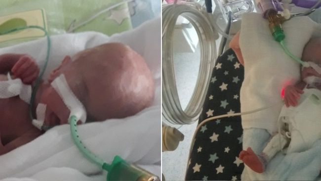 Michalina urodziła się ważąc 370 g. To druga najmniejsza dziewczynka w Polsce