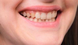 Zęby robią się żółte? Dentysta mówi o nagminnym błędzie